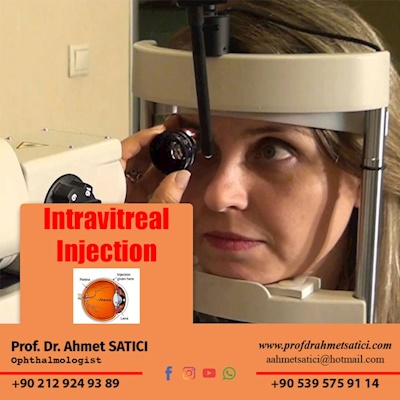 Intravitreal Injection (Eye Injection)