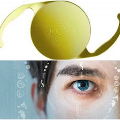 TRİFOKAL  AKILLI LENS CERRAHİSİ